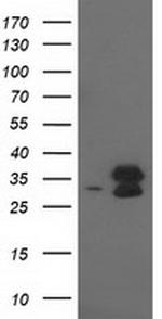 EIF4E2 Antibody in Western Blot (WB)