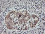 EIF5A2 Antibody in Immunohistochemistry (Paraffin) (IHC (P))