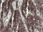 EIF5A2 Antibody in Immunohistochemistry (Paraffin) (IHC (P))