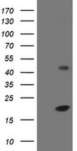 EIF5A2 Antibody in Western Blot (WB)