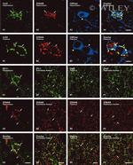 ZONAB Antibody in Immunohistochemistry (IHC)