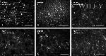 MUPP1 Antibody in Immunohistochemistry (IHC)