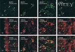 MUPP1 Antibody in Immunohistochemistry (IHC)