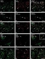 MUPP1 Antibody in Immunohistochemistry (IHC)