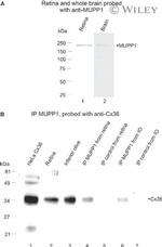 MUPP1 Antibody in Western Blot (WB)