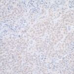 ELAC2 Antibody in Immunohistochemistry (IHC)