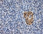 ELAVL1 Antibody in Immunohistochemistry (Paraffin) (IHC (P))