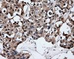 ELAVL1 Antibody in Immunohistochemistry (Paraffin) (IHC (P))