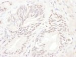 ELK1 Antibody in Immunohistochemistry (IHC)