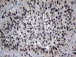 ELL Antibody in Immunohistochemistry (Paraffin) (IHC (P))