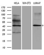 ELP4 Antibody in Western Blot (WB)