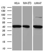 ELP4 Antibody in Western Blot (WB)