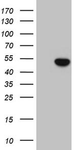 ELP4 Antibody in Western Blot (WB)