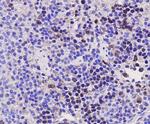 PCNA Antibody in Immunohistochemistry (Paraffin) (IHC (P))