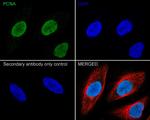 PCNA Antibody in Immunohistochemistry (Paraffin) (IHC (P))