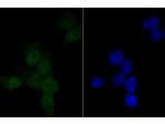 PARP1 Antibody in Immunocytochemistry (ICC/IF)