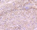 PARP1 Antibody in Immunohistochemistry (Paraffin) (IHC (P))