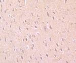 PARP1 Antibody in Immunohistochemistry (Paraffin) (IHC (P))