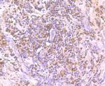 PARP1 Antibody in Immunohistochemistry (Paraffin) (IHC (P))