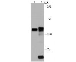 PARP1 Antibody in Western Blot (WB)