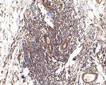 Glucocorticoid Receptor alpha Antibody in Immunohistochemistry (Paraffin) (IHC (P))