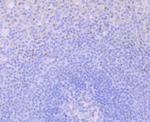 Glucocorticoid Receptor alpha Antibody in Immunohistochemistry (Paraffin) (IHC (P))