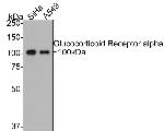 Glucocorticoid Receptor alpha Antibody in Western Blot (WB)