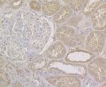 NQO1 Antibody in Immunohistochemistry (Paraffin) (IHC (P))