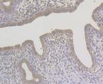 NQO1 Antibody in Immunohistochemistry (Paraffin) (IHC (P))