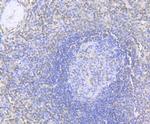 MMP9 Antibody in Immunohistochemistry (Paraffin) (IHC (P))