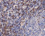 ZAP70 Antibody in Immunohistochemistry (Paraffin) (IHC (P))