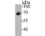 ZAP70 Antibody in Western Blot (WB)