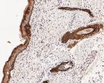 Cytokeratin 17 Antibody in Immunohistochemistry (Paraffin) (IHC (P))