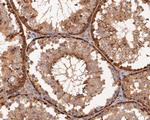 ERK2 Antibody in Immunohistochemistry (Paraffin) (IHC (P))