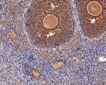 ERK2 Antibody in Immunohistochemistry (Paraffin) (IHC (P))