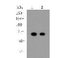 Albumin Antibody in Western Blot (WB)