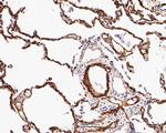 Caveolin-1 Antibody in Immunohistochemistry (Paraffin) (IHC (P))