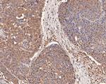 COX2 Antibody in Immunohistochemistry (Paraffin) (IHC (P))