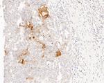 MUC1 Antibody in Immunohistochemistry (Paraffin) (IHC (P))