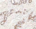 MUC1 Antibody in Immunohistochemistry (Paraffin) (IHC (P))