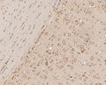 HSP90 Beta Antibody in Immunohistochemistry (Paraffin) (IHC (P))