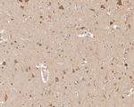 HSP90 Beta Antibody in Immunohistochemistry (Paraffin) (IHC (P))