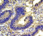 MAPK14 Antibody in Immunohistochemistry (Paraffin) (IHC (P))