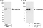 ENAH/MENA Antibody in Western Blot (WB)