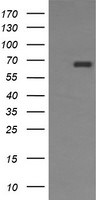 ENG Antibody in Western Blot (WB)