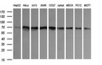 ENG Antibody in Western Blot (WB)