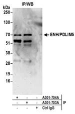 ENH/PDLIM5 Antibody in Western Blot (WB)