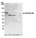 ENH/PDLIM5 Antibody in Western Blot (WB)