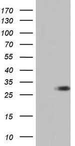 ENKUR Antibody in Western Blot (WB)