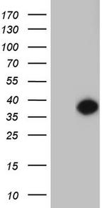 ENKUR Antibody in Western Blot (WB)